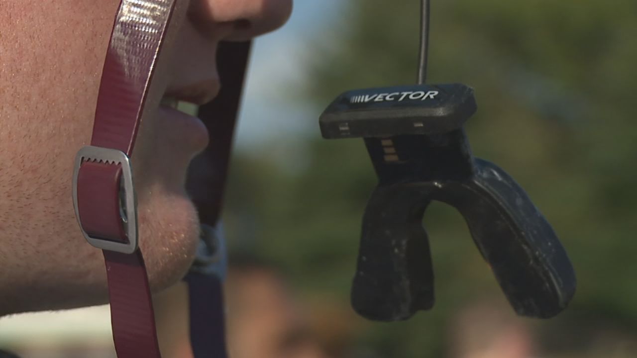 IU concussion study mouthpiece